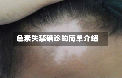 色素失禁确诊的简单介绍-第3张图片