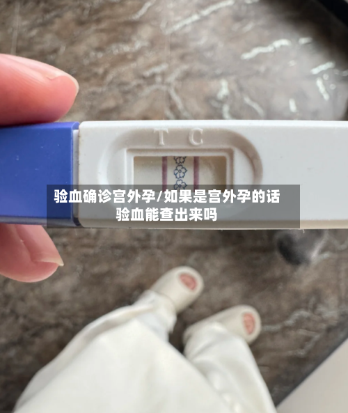 验血确诊宫外孕/如果是宫外孕的话验血能查出来吗