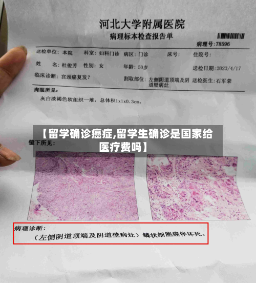 【留学确诊癌症,留学生确诊是国家给医疗费吗】-第2张图片