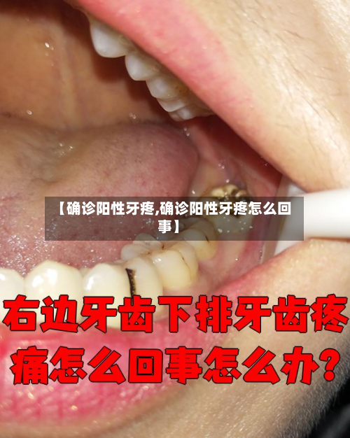 【确诊阳性牙疼,确诊阳性牙疼怎么回事】-第3张图片