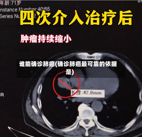 谁能确诊肺癌(确诊肺癌最可靠的依据是)-第2张图片
