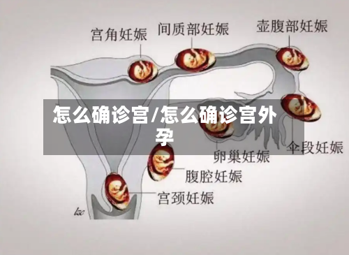 怎么确诊宫/怎么确诊宫外孕-第2张图片