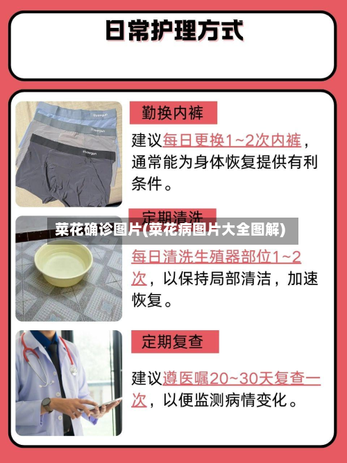 菜花确诊图片(菜花病图片大全图解)-第2张图片