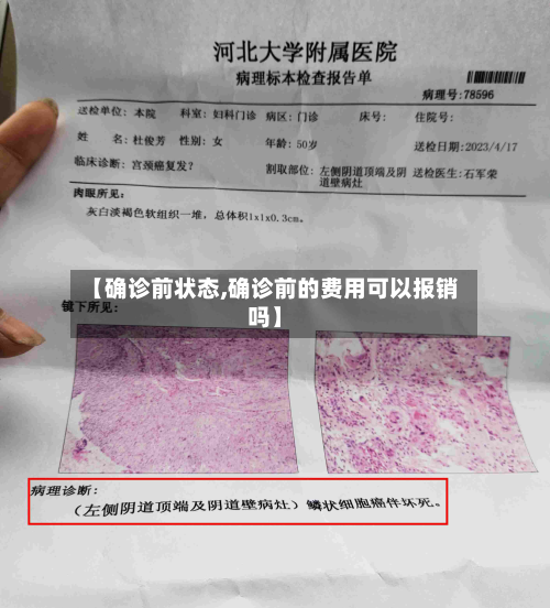 【确诊前状态,确诊前的费用可以报销吗】-第3张图片