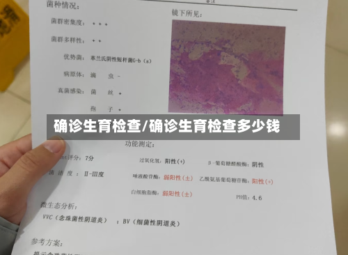 确诊生育检查/确诊生育检查多少钱