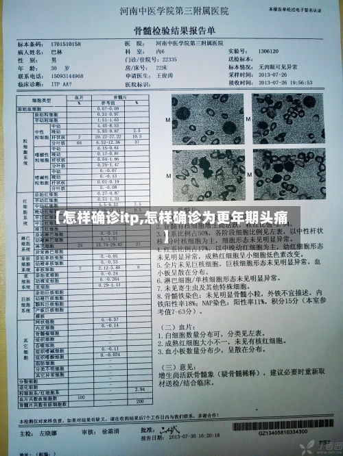 【怎样确诊itp,怎样确诊为更年期头痛】
