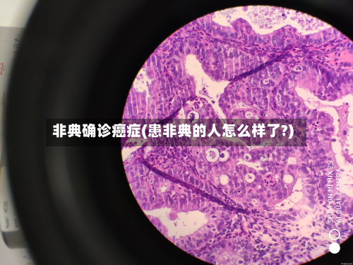 非典确诊癌症(患非典的人怎么样了?)-第3张图片