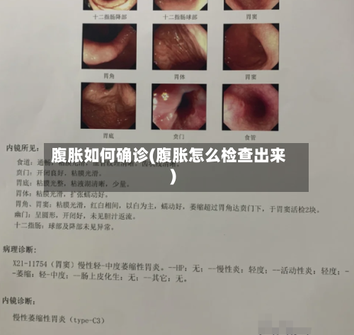 腹胀如何确诊(腹胀怎么检查出来)