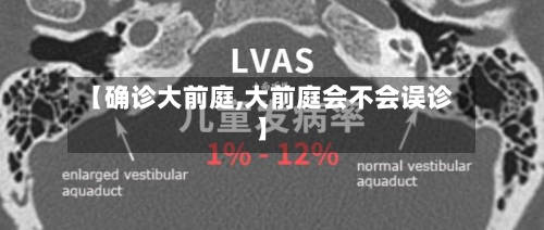 【确诊大前庭,大前庭会不会误诊】-第2张图片
