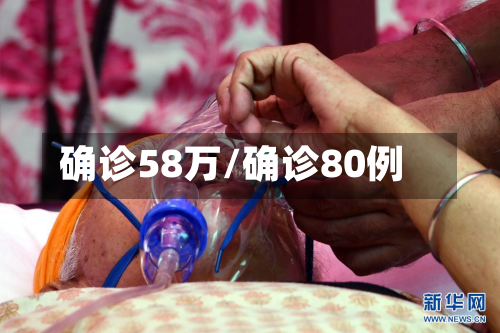 确诊58万/确诊80例-第2张图片
