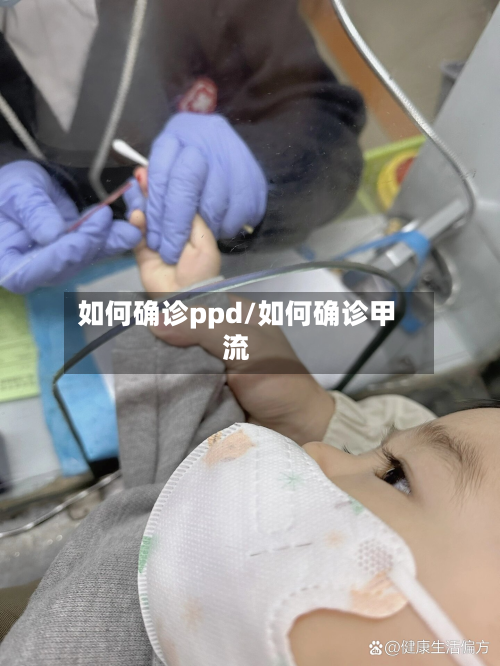 如何确诊ppd/如何确诊甲流