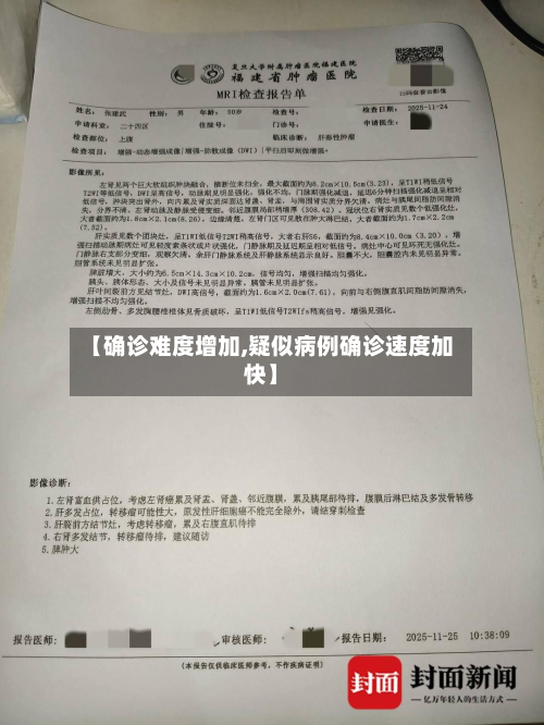【确诊难度增加,疑似病例确诊速度加快】-第2张图片