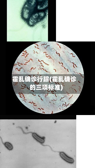 霍乱确诊行踪(霍乱确诊的三项标准)