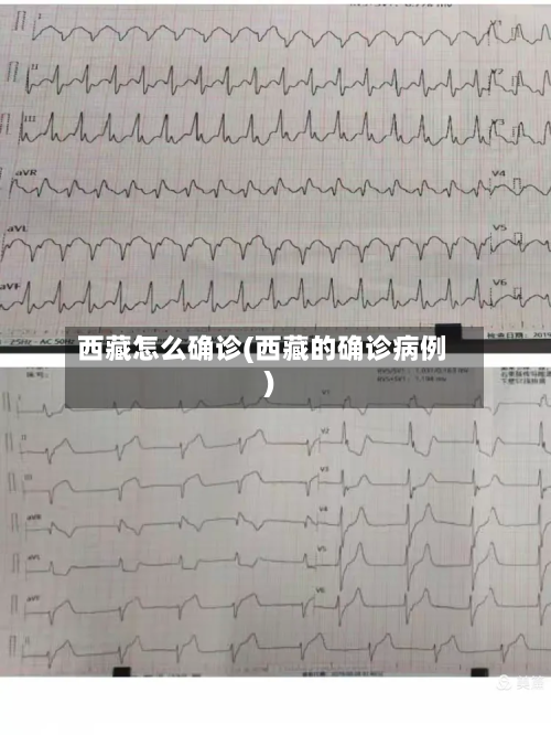 西藏怎么确诊(西藏的确诊病例)-第2张图片