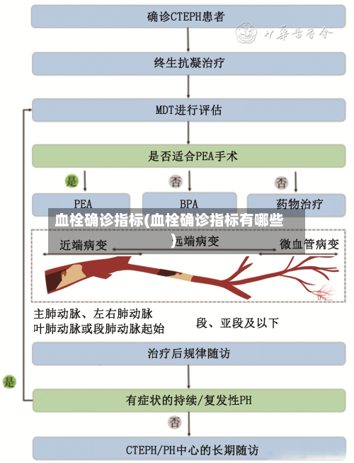 血栓确诊指标(血栓确诊指标有哪些)-第2张图片