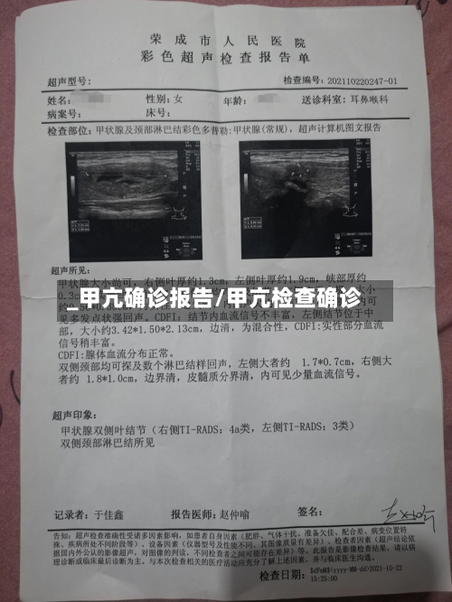 _甲亢确诊报告/甲亢检查确诊