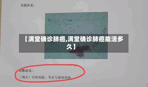 【满堂确诊肺癌,满堂确诊肺癌能活多久】