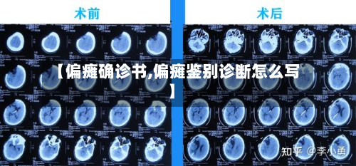 【偏瘫确诊书,偏瘫鉴别诊断怎么写】