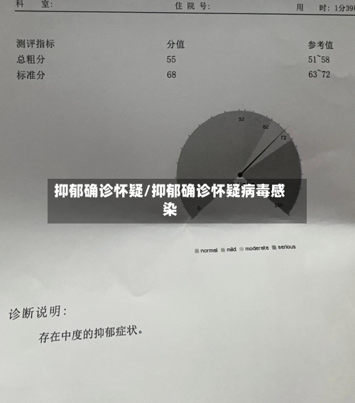 抑郁确诊怀疑/抑郁确诊怀疑病毒感染-第2张图片