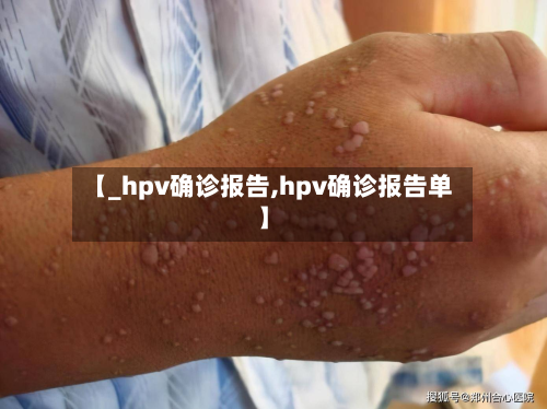 【_hpv确诊报告,hpv确诊报告单】-第2张图片