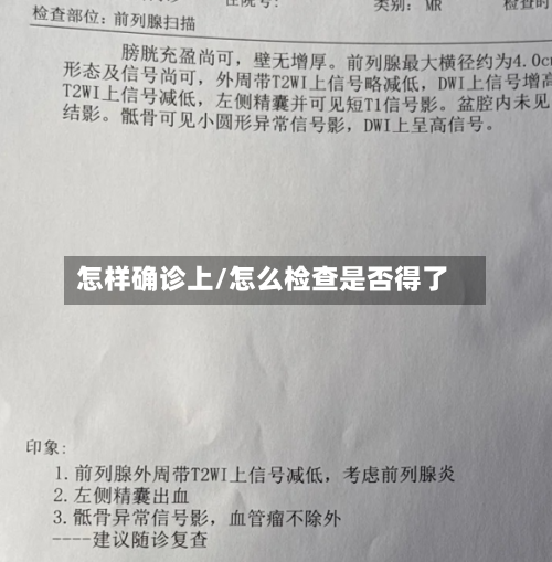 怎样确诊上/怎么检查是否得了-第2张图片