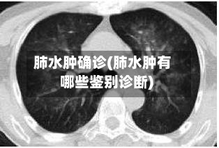 肺水肿确诊(肺水肿有哪些鉴别诊断)-第2张图片