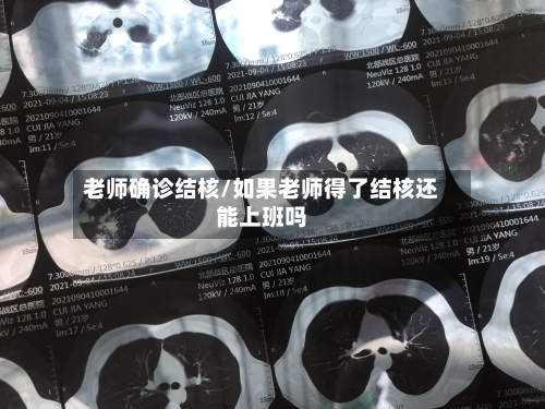 老师确诊结核/如果老师得了结核还能上班吗