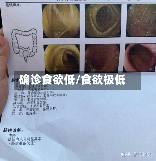 确诊食欲低/食欲极低