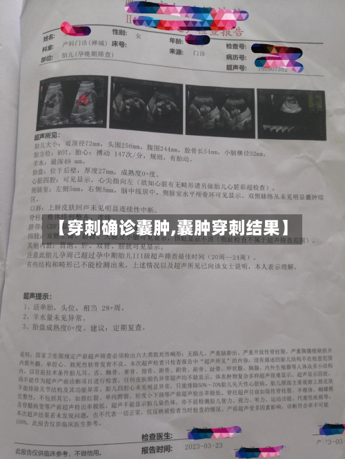 【穿刺确诊囊肿,囊肿穿刺结果】