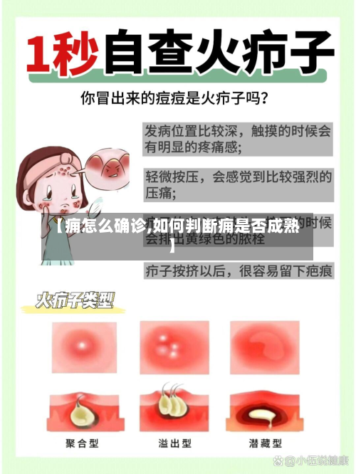 【痈怎么确诊,如何判断痈是否成熟】-第2张图片