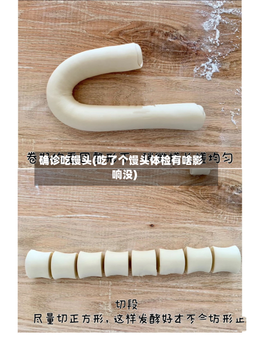 确诊吃馒头(吃了个馒头体检有啥影响没)-第2张图片