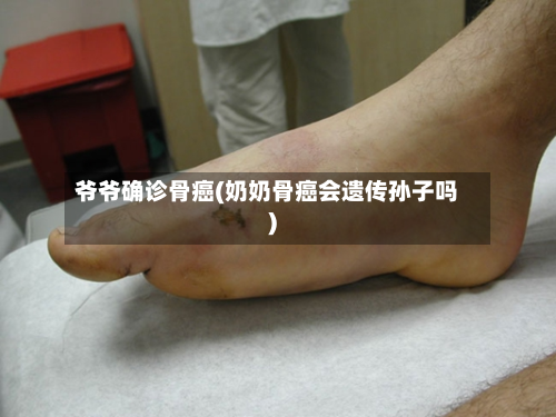 爷爷确诊骨癌(奶奶骨癌会遗传孙子吗)-第2张图片