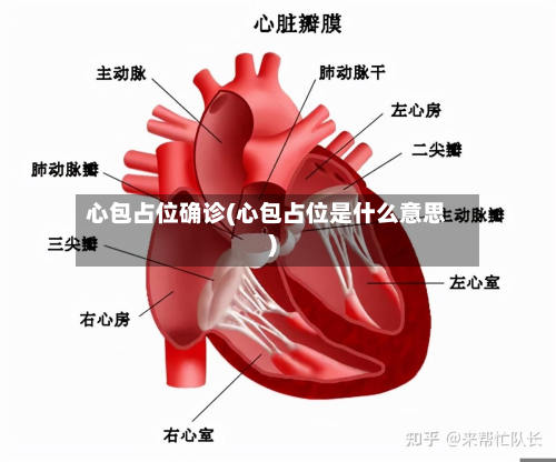 心包占位确诊(心包占位是什么意思)
