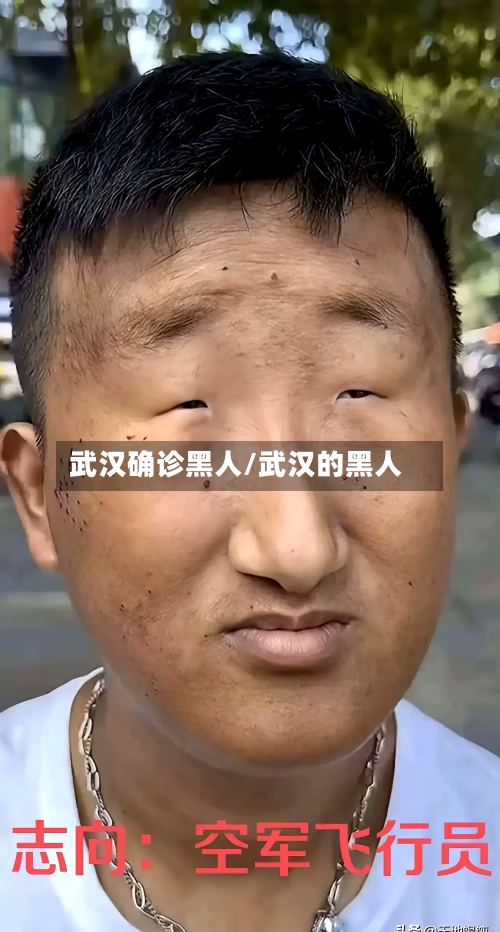 武汉确诊黑人/武汉的黑人-第2张图片