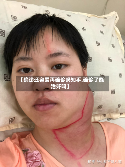 【确诊还容易再确诊吗知乎,确诊了能治好吗】-第3张图片