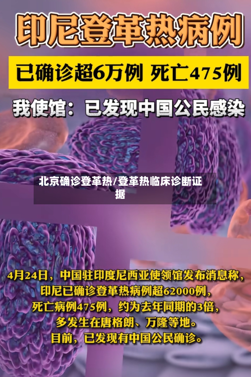 北京确诊登革热/登革热临床诊断证据-第2张图片
