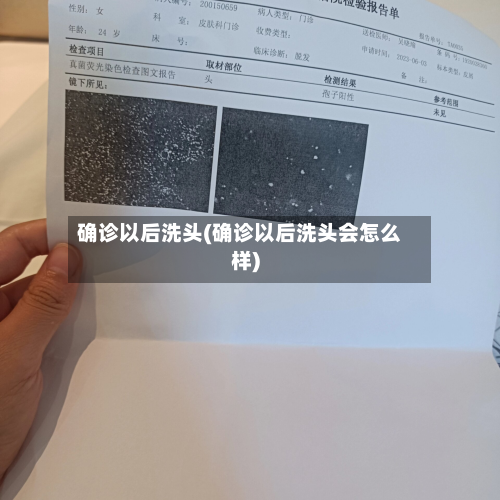 确诊以后洗头(确诊以后洗头会怎么样)-第2张图片
