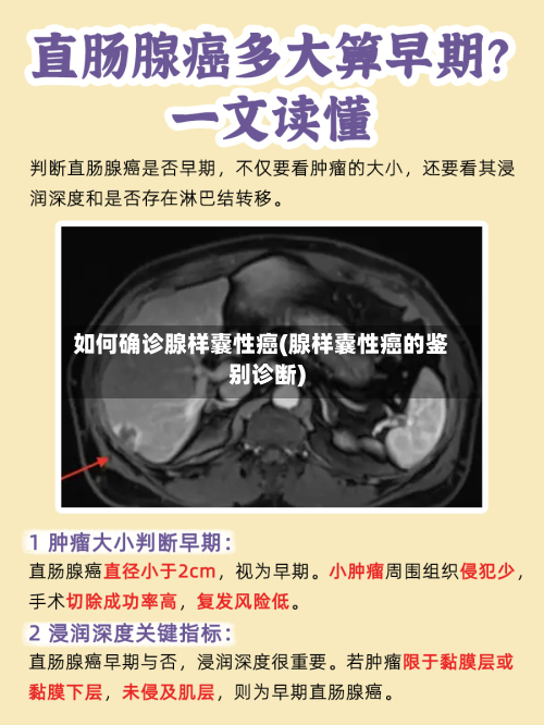 如何确诊腺样囊性癌(腺样囊性癌的鉴别诊断)-第2张图片