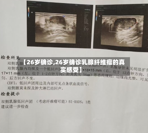 【26岁确诊,26岁确诊乳腺纤维瘤的真实感受】
