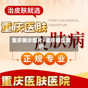 重庆确诊图片/重庆确诊案例