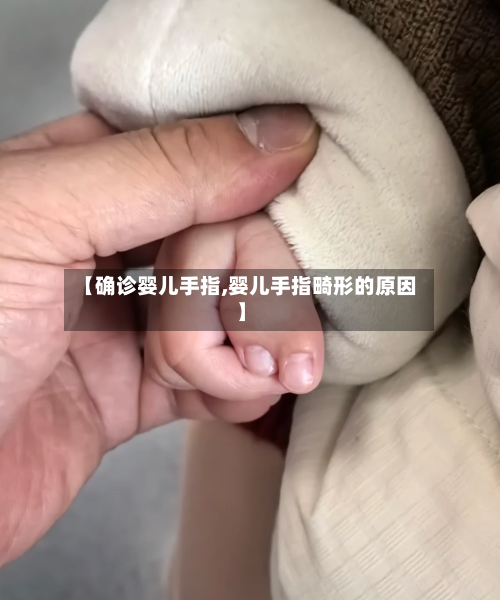 【确诊婴儿手指,婴儿手指畸形的原因】-第2张图片
