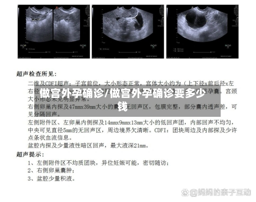 做宫外孕确诊/做宫外孕确诊要多少钱