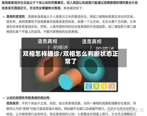 双相怎样确诊/双相怎么判断状态正常了-第3张图片