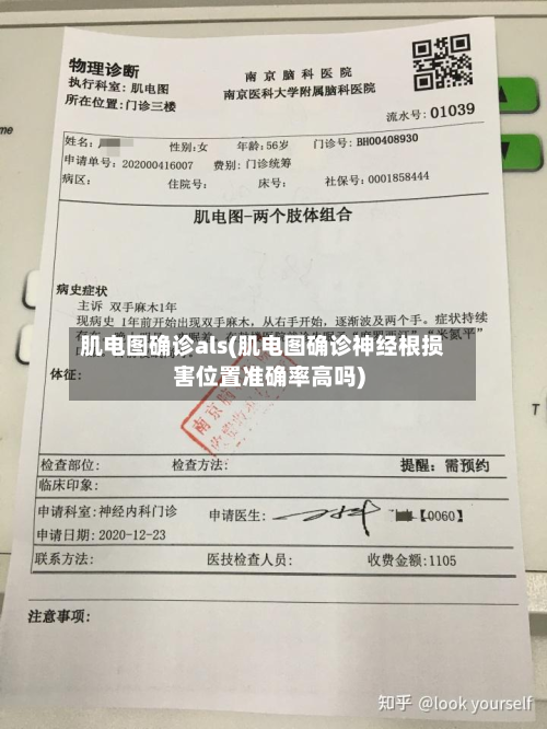 肌电图确诊als(肌电图确诊神经根损害位置准确率高吗)-第2张图片