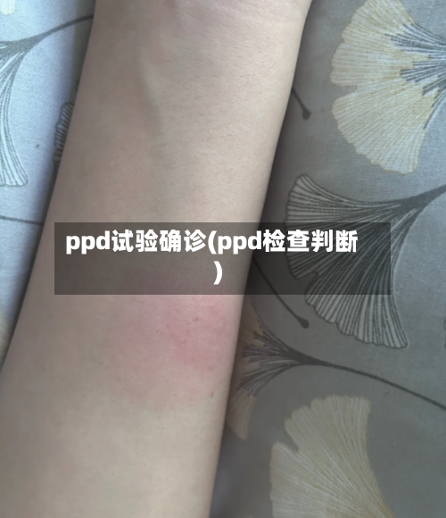 ppd试验确诊(ppd检查判断)