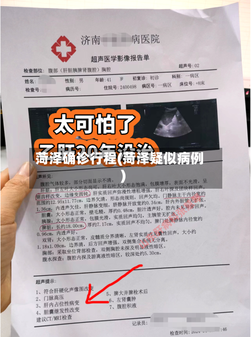 菏泽确诊行程(菏泽疑似病例)-第2张图片