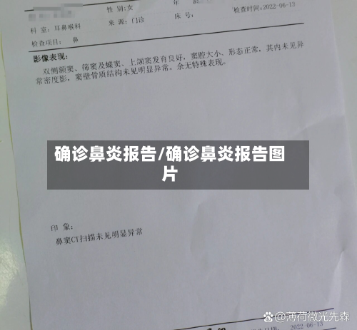 确诊鼻炎报告/确诊鼻炎报告图片-第2张图片