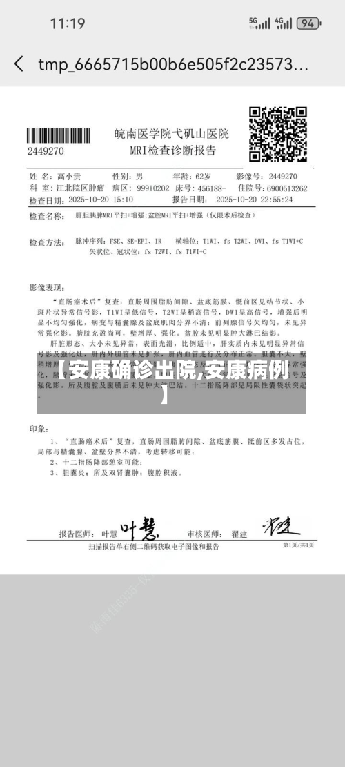 【安康确诊出院,安康病例】