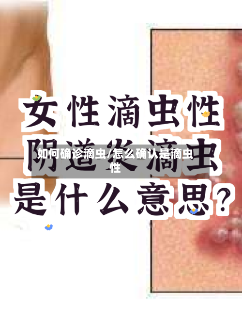 如何确诊滴虫/怎么确认是滴虫性-第2张图片