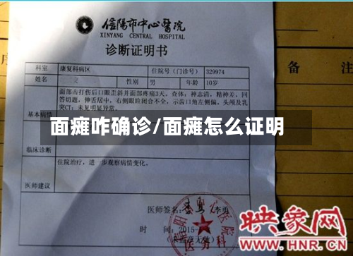 面瘫咋确诊/面瘫怎么证明-第2张图片